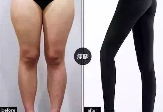 【躺著都能光速瘦身的打底健身褲】日本瘦身黑科技，10倍燃脂塑形，讓你越穿越瘦，透氣不悶汗，收腹提臀！vanvene光速瘦腿褲 健康 第16張