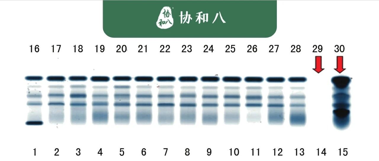 神秘的血清蛋白电泳 | 协和八