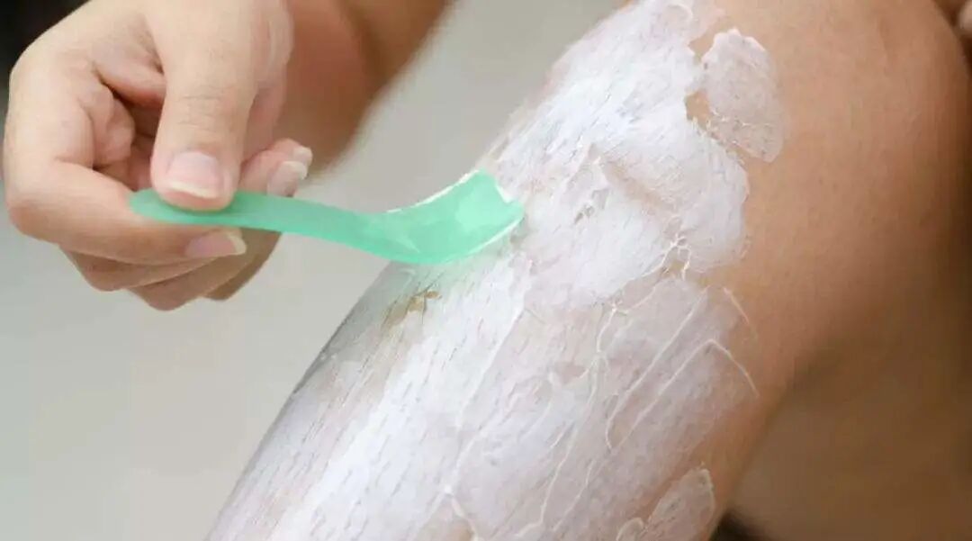 医用脱毛剂是什么腿毛比头发多，怎么办在线等！｜协和八_https://www.jmylbn.com_新闻资讯_第4张