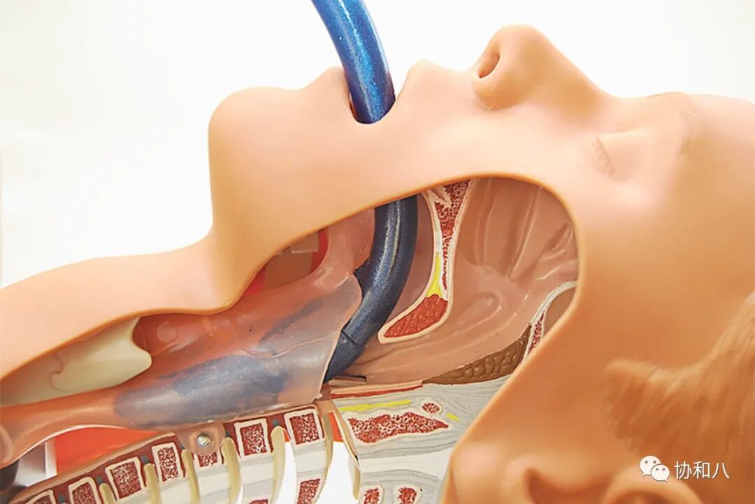 为什么要用喉罩ABCD的A（airway）-「喉罩」使用指南 ｜_https://www.jmylbn.com_新闻资讯_第7张