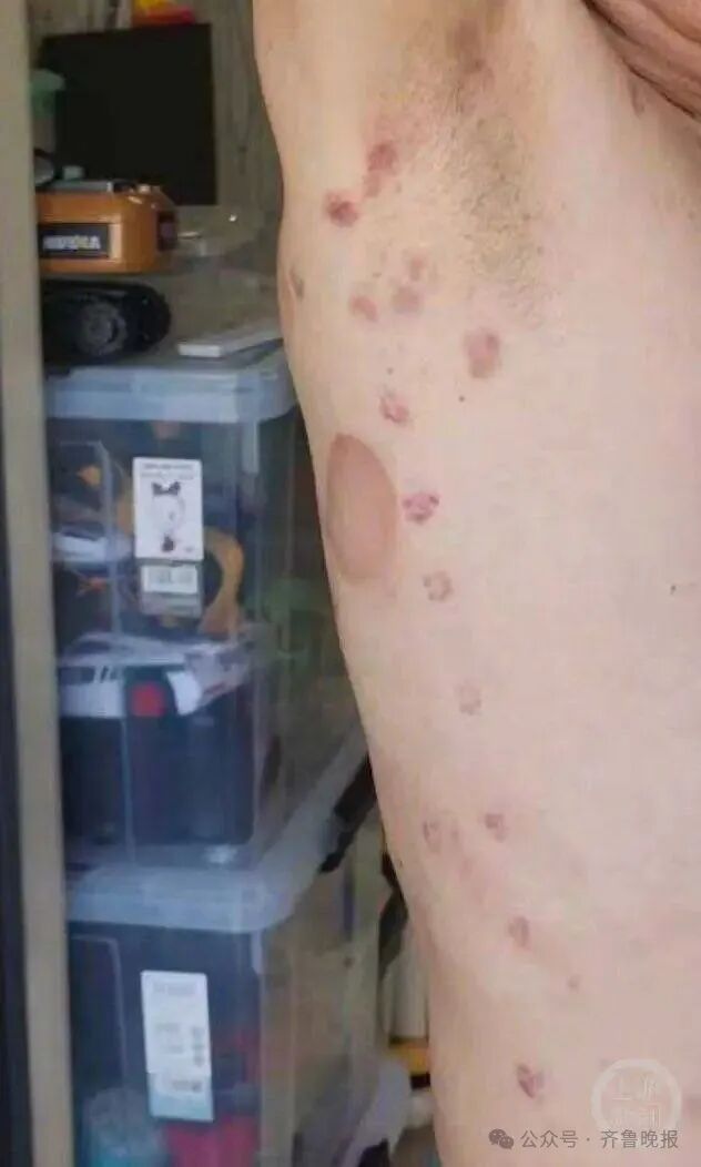 家里没工具怎么灌肠“服务的跪着说家里穷”！男子2年在一理发店充值430多万，多次做灌肠和针刺排毒后不适，遭遇退费难，公安机关已联合调查_https://www.jmylbn.com_新闻资讯_第4张