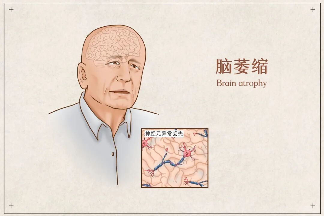 半包装修包括哪些