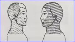 为什么要叫备皮刀“感术 ”行动 ｜｜ 院感说备皮刀不符合要求，备皮怎么办？常见备皮、消毒范围_https://www.jmylbn.com_新闻资讯_第7张