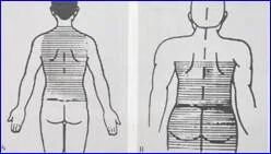 为什么要叫备皮刀“感术 ”行动 ｜｜ 院感说备皮刀不符合要求，备皮怎么办？常见备皮、消毒范围_https://www.jmylbn.com_新闻资讯_第12张