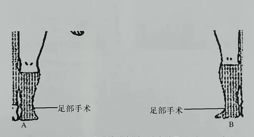 为什么要叫备皮刀“感术 ”行动 ｜｜ 院感说备皮刀不符合要求，备皮怎么办？常见备皮、消毒范围_https://www.jmylbn.com_新闻资讯_第18张