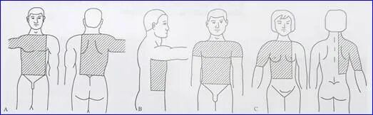 为什么要叫备皮刀“感术 ”行动 ｜｜ 院感说备皮刀不符合要求，备皮怎么办？常见备皮、消毒范围_https://www.jmylbn.com_新闻资讯_第10张