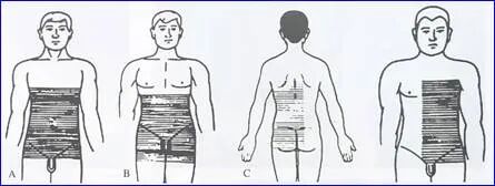 为什么要叫备皮刀“感术 ”行动 ｜｜ 院感说备皮刀不符合要求，备皮怎么办？常见备皮、消毒范围_https://www.jmylbn.com_新闻资讯_第11张