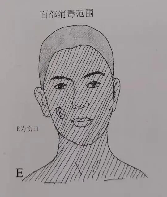 为什么要叫备皮刀“感术 ”行动 ｜｜ 院感说备皮刀不符合要求，备皮怎么办？常见备皮、消毒范围_https://www.jmylbn.com_新闻资讯_第6张