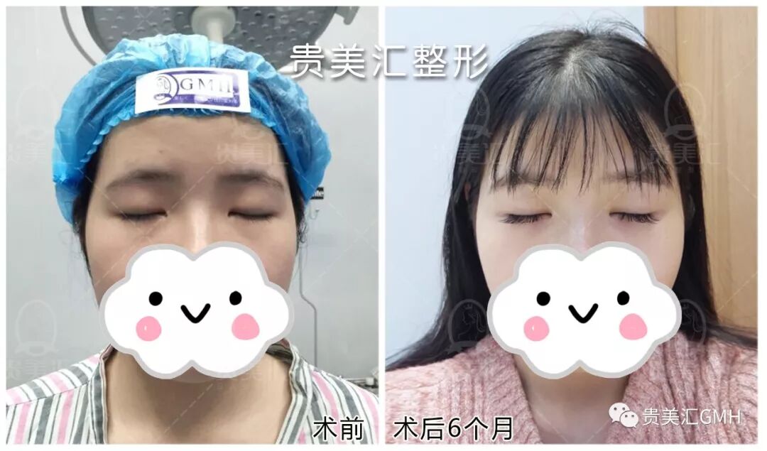 What 我的女孩 李多海整到脸僵 李栋旭却从路人变男神 贵美汇日式整形 微信公众号文章阅读 Wemp