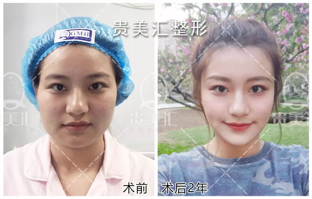 



大饼脸居然变成V脸仙女，怎么做到的？！
