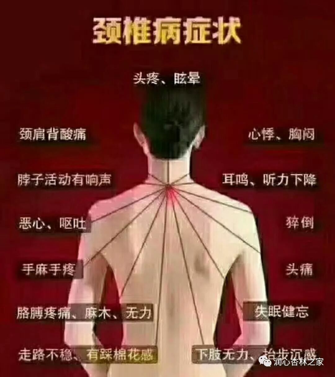 颈椎间盘突出不要怕 预防和调理是妙招 润心杏林之家 微信公众号文章阅读 Wemp