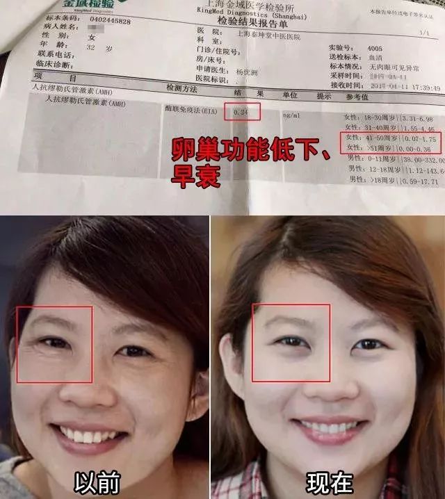 64岁的香港女人竟有岁的脸 没有整容 只因每天吃点它 婞读 微信公众号文章阅读 Wemp
