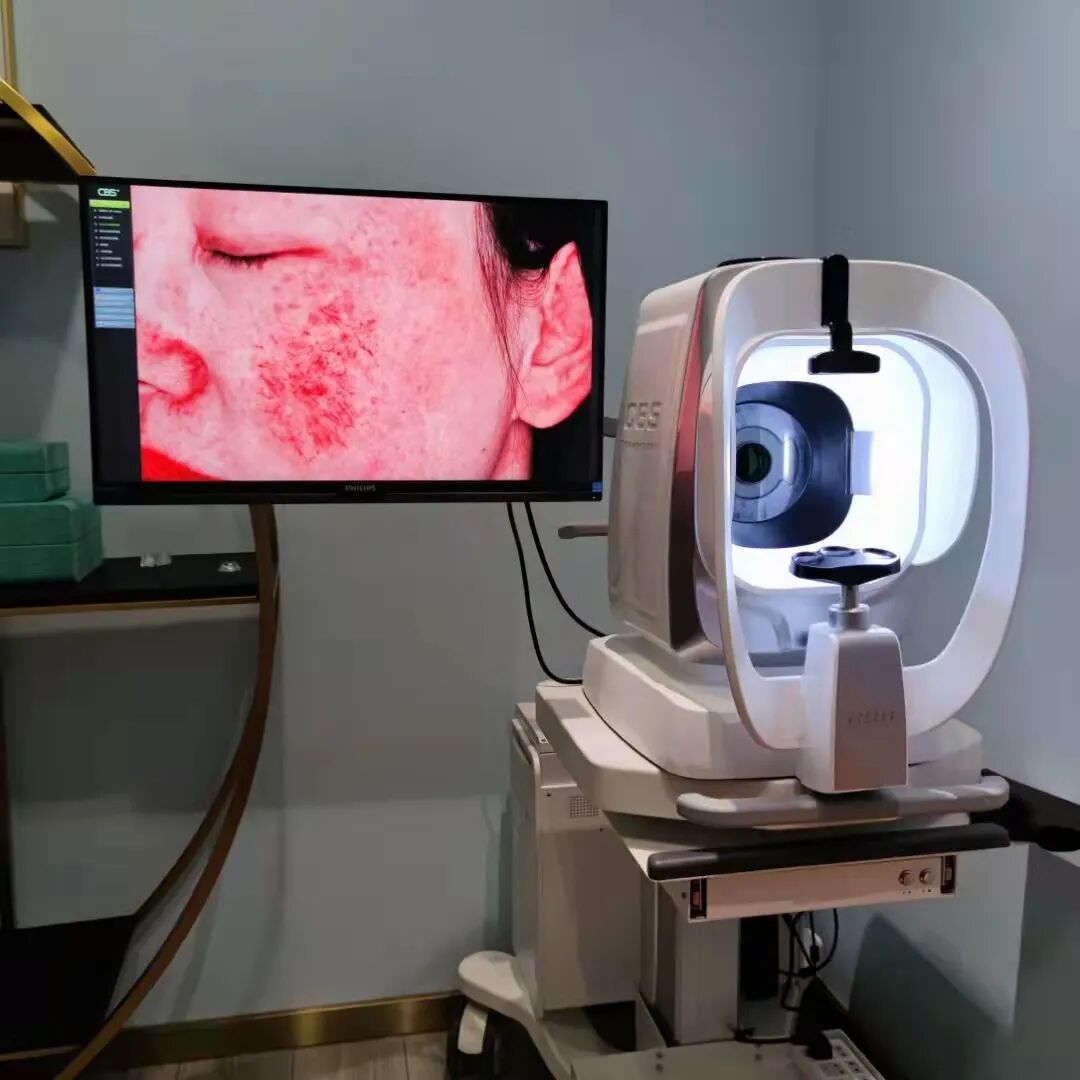 多光谱人工智能皮肤诊断系统(cbs云镜)落户延安大学附属医院医学美容