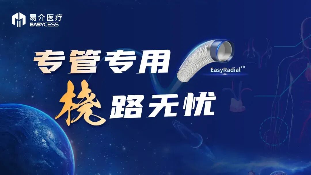 什么西蒙导管应用EasyRadial™输送导管行单纯弹簧圈栓塞及支架辅助弹簧圈治疗动脉瘤临床实践4例-上海聚慕医疗器械有限公司