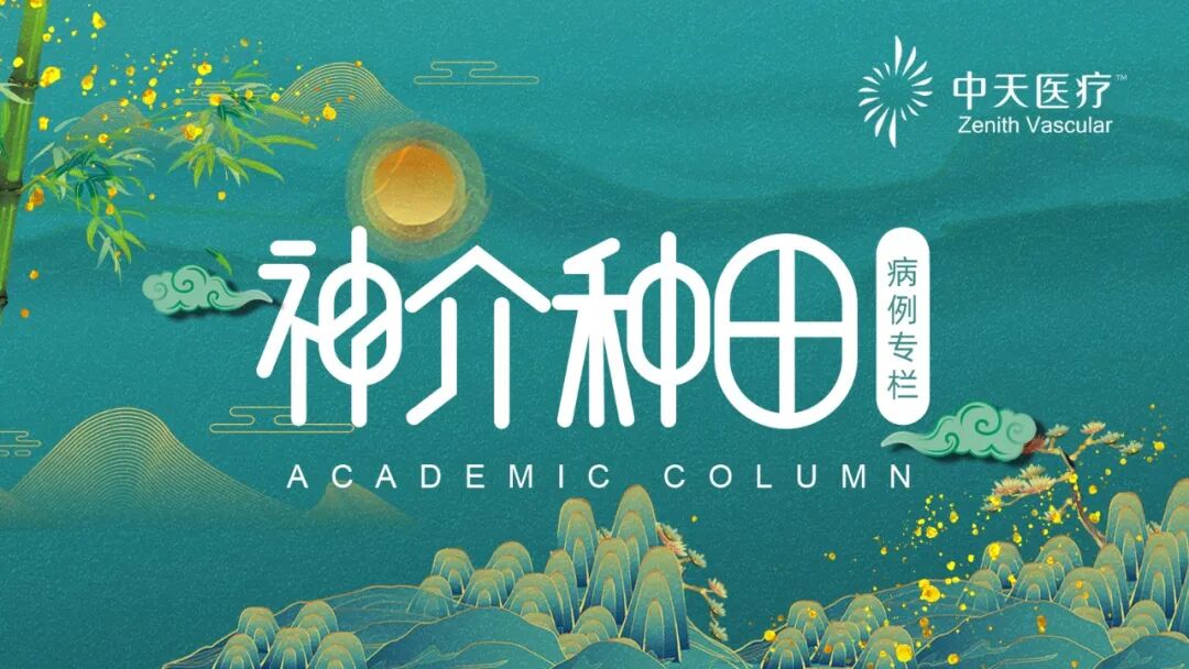 单弯导管是什么【神介种田】病例系列 ｜ 前循环取栓病例-上海聚慕医疗器械有限公司