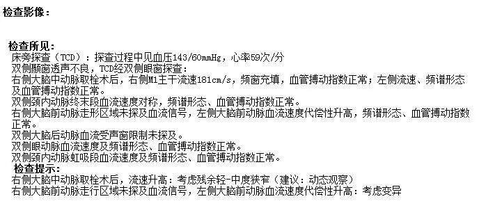 什么叫桡鞘【例久弥新】寻道于桡——瑞康通5.5F IntroSky X导管鞘经桡动脉行右侧大脑中动脉取栓一例_https://www.jmylbn.com_新闻资讯_第34张