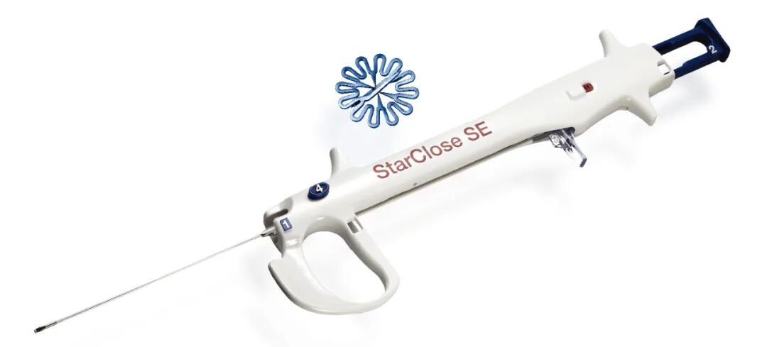 血管闭合系统是什么缝闭生辉 ｜ 血管闭合器在颅内动脉取栓术中的应用_https://www.jmylbn.com_新闻资讯_第17张