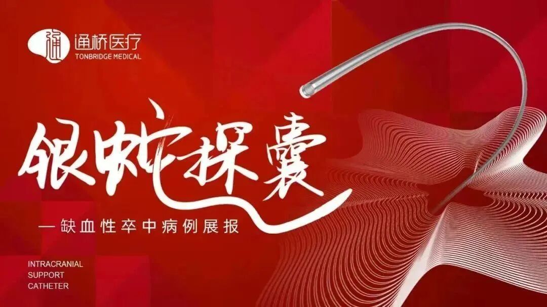 单弯导管是什么【通桥•银蛇探囊】通桥银蛇®颅内支持导管在基底动脉重度狭窄血管内介入治疗中的应用一例-上海聚慕医疗器械有限公司