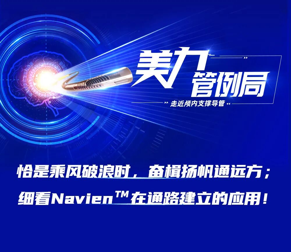 加强支撑用什么导管美力管例局 ｜ 专访李立教授：恰是乘风破浪时，奋楫扬帆通远方；细看 Navien™在通路建立的应用！-上海聚慕医疗器械有限公司