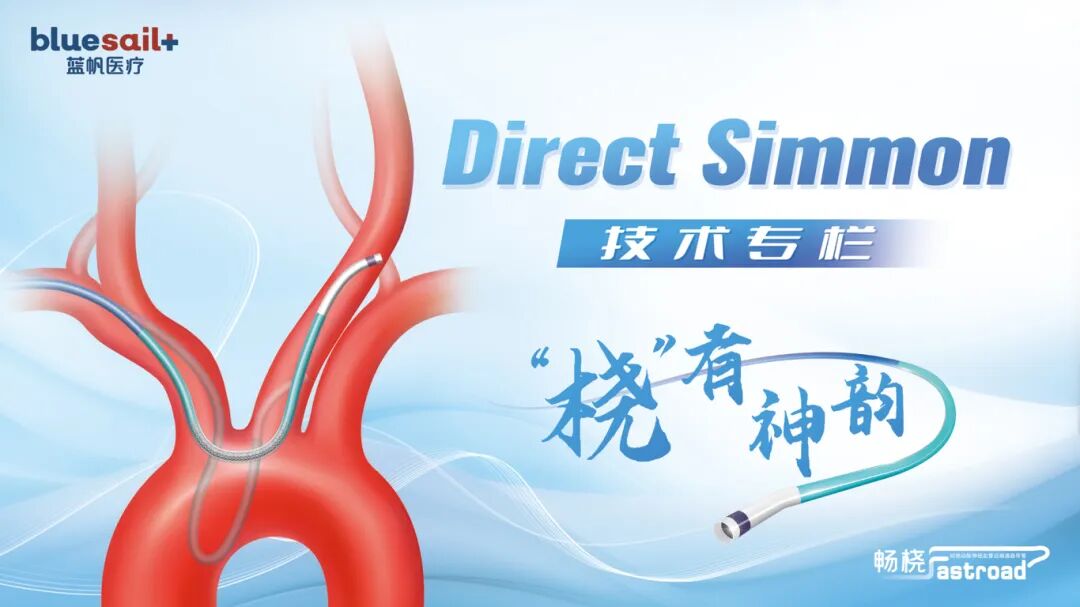 什么西蒙导管桡有神韵｜Simmon弯型导引导管应用于左侧大脑中动脉闭塞开通病例-上海聚慕医疗器械有限公司