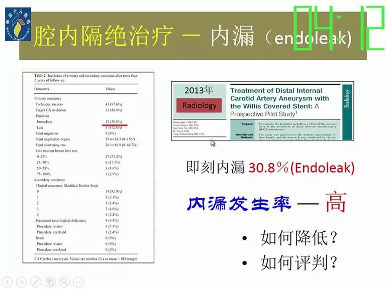 方淳教授willis覆膜支架的臨床應用及思考ocin2017精彩回顧