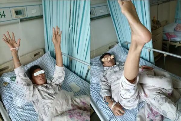 导丝怎么扩【载药时代 球扩天下】NOVA DES®颅内药物洗脱支架在颈内动脉颅内段重度狭窄的应用两例！滕州市中心医院&山西医科大学第二医院_https://www.jmylbn.com_新闻资讯_第11张