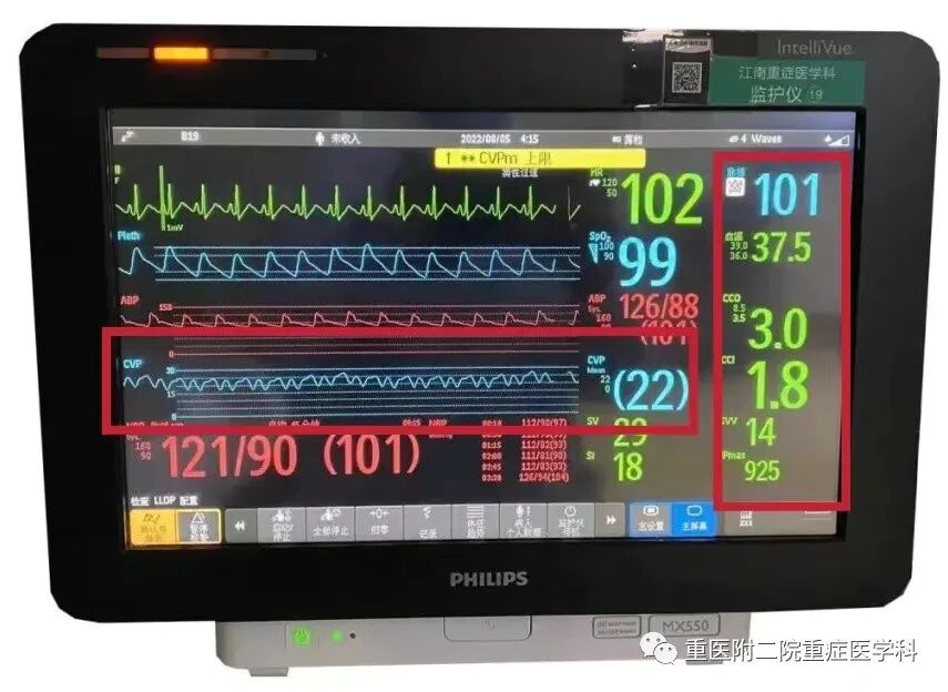医疗监测性管道有哪些【重症科普你我他】之浅识ICU常见管道_https://www.jmylbn.com_新闻资讯_第19张