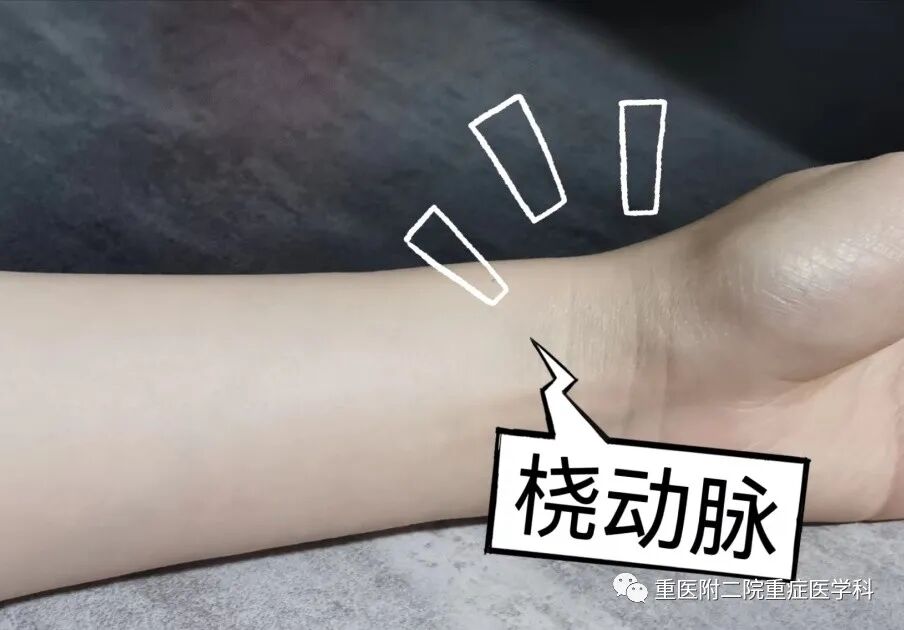 医疗监测性管道有哪些【重症科普你我他】之浅识ICU常见管道_https://www.jmylbn.com_新闻资讯_第13张