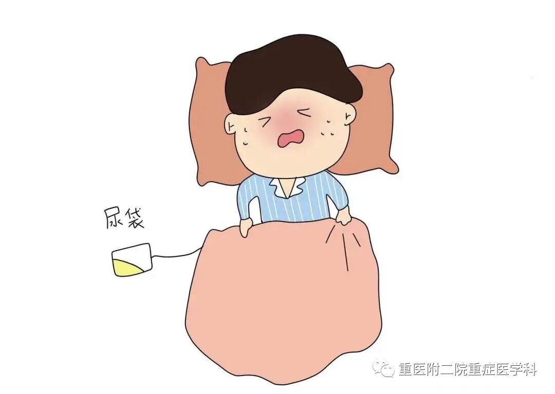 医疗监测性管道有哪些【重症科普你我他】之浅识ICU常见管道_https://www.jmylbn.com_新闻资讯_第3张