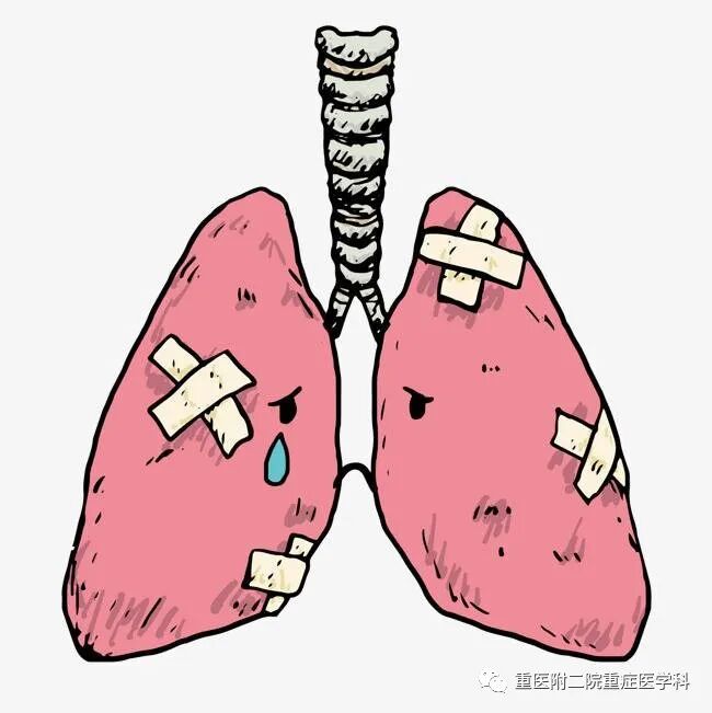 医疗监测性管道有哪些【重症科普你我他】之浅识ICU常见管道_https://www.jmylbn.com_新闻资讯_第37张