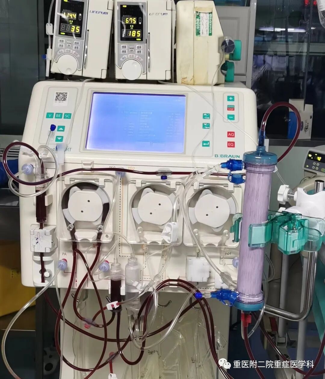 医疗监测性管道有哪些【重症科普你我他】之浅识ICU常见管道_https://www.jmylbn.com_新闻资讯_第33张