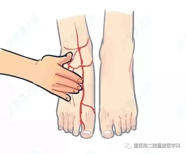 医疗监测性管道有哪些【重症科普你我他】之浅识ICU常见管道_https://www.jmylbn.com_新闻资讯_第14张