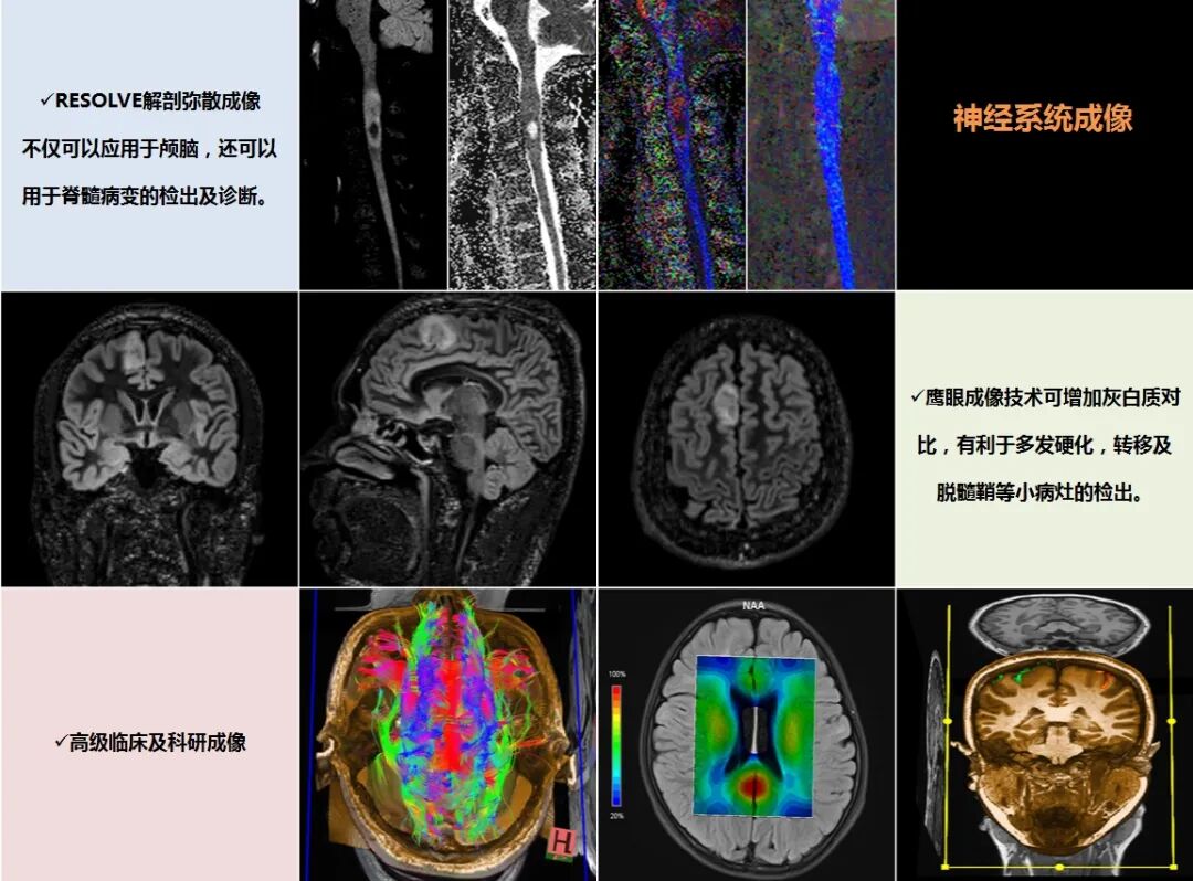磁共振矩阵怎么计算【市一桐庐医院新设备展示】西门子 Vida 3.0T 磁共振——世界上首台具备生命矩阵系统的磁共振系统_https://www.jmylbn.com_新闻资讯_第6张