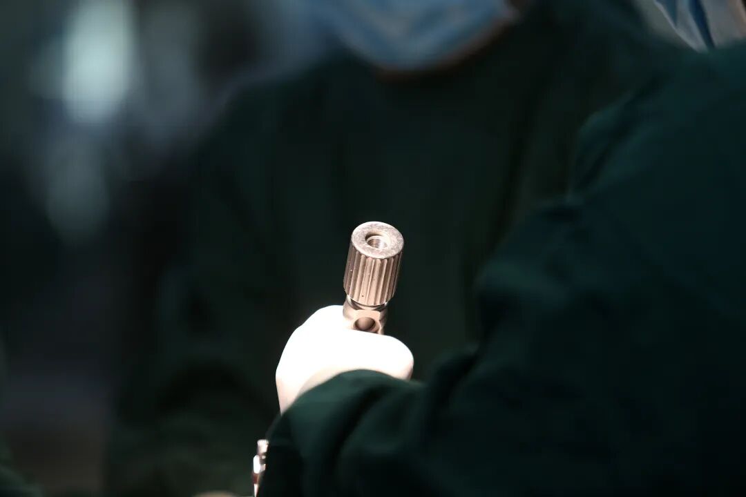 手术耗材是什么高值耗材集采落地半年后，手术医生：厂家明显变懒了_https://www.jmylbn.com_新闻资讯_第2张