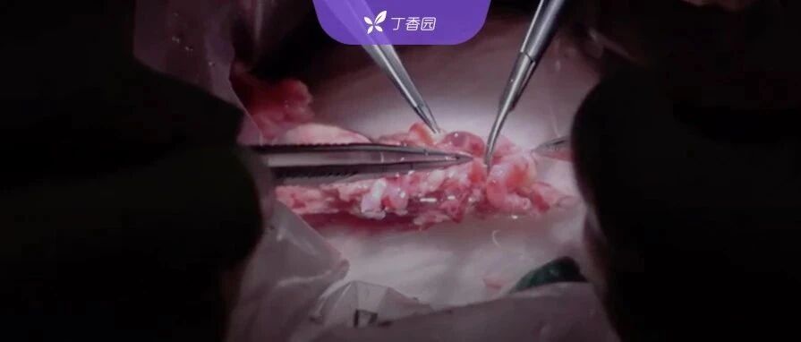 世界首例人类气管移植：因学术造假停滞 5 年后，该领域首获成功