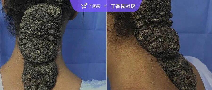 2024-02-13药事资讯