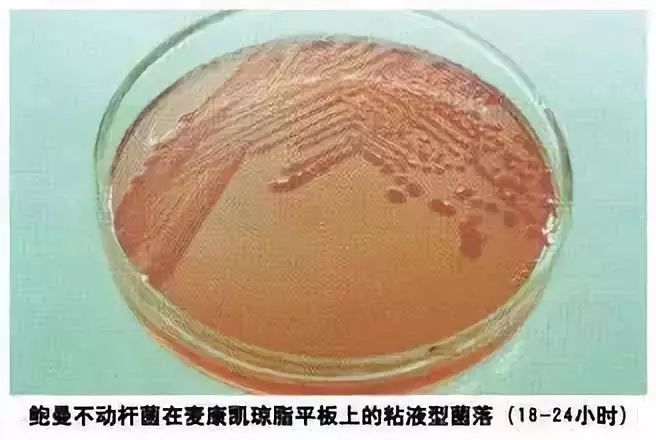 延禧攻略：高貴妃究竟死於哪種細菌感染？ 健康 第9張