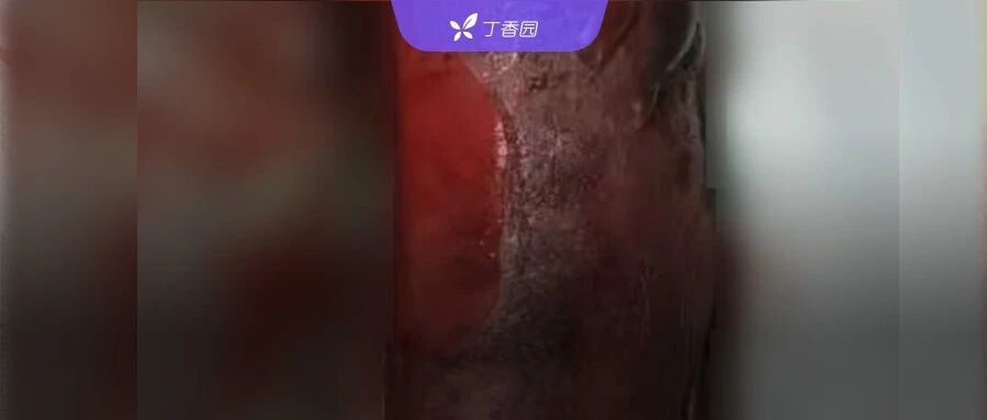 2025-06-01药事资讯