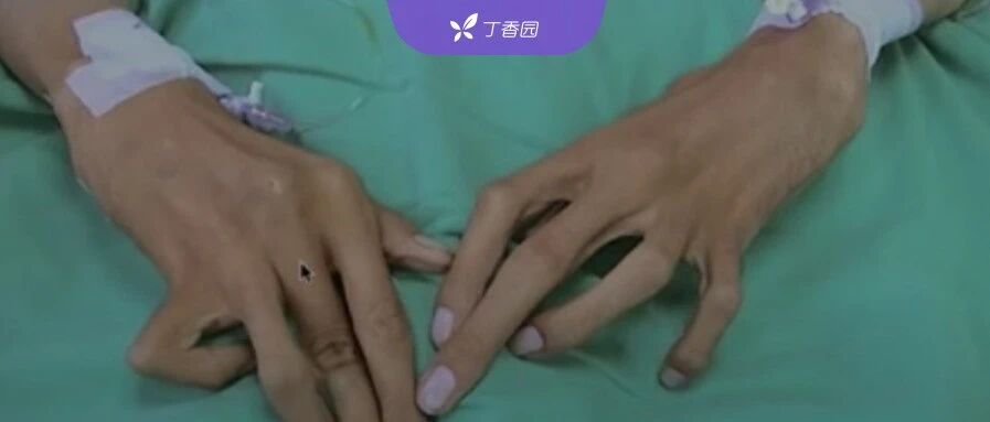 1 米 9 小伙门诊抽搐 4 次，主任束手无策，原因竟藏在 20 年前