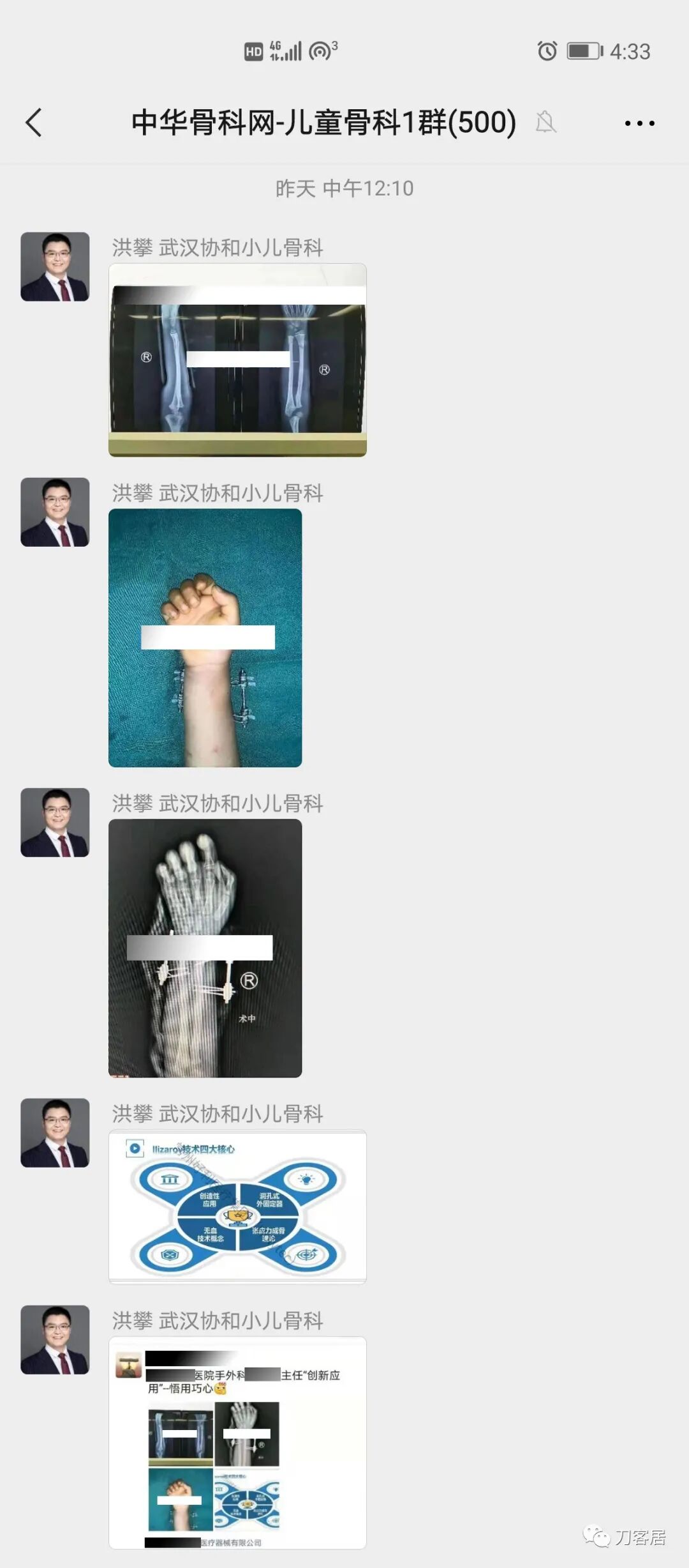 聚酯石膏怎么打6岁孩子的尺桡骨双骨折，就给手术了？外固定架外面还打石膏？_https://www.jmylbn.com_新闻资讯_第1张