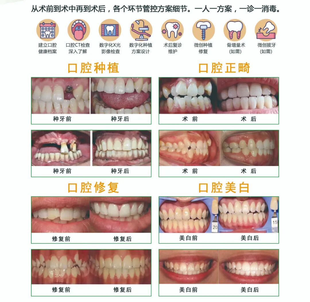 数字牙片机怎么用​【博海科室推荐】口腔 · 种植正畸数字化中心，升级改造  正式启用_https://www.jmylbn.com_新闻资讯_第24张