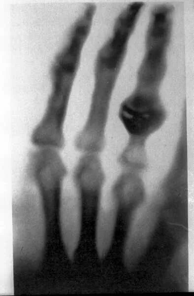 c射线是什么什么是X射线？_https://www.jmylbn.com_新闻资讯_第5张