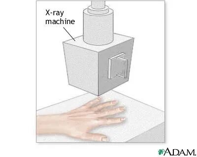 c射线是什么什么是X射线？_https://www.jmylbn.com_新闻资讯_第2张