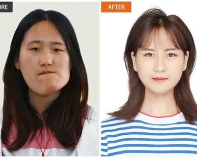 “歪脸女孩”，笑了……