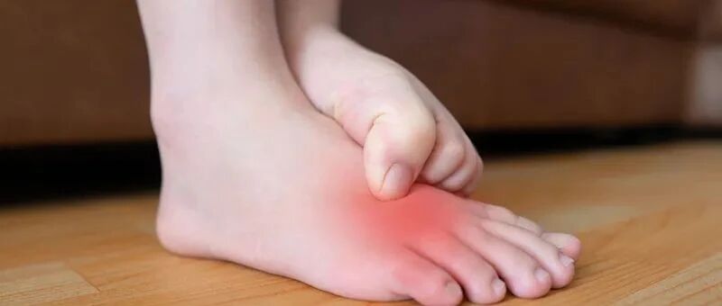 女子爱穿尖头鞋竟患上这种“瘤”！不同脚型该怎么选鞋？今天说清楚了