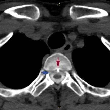 警惕！长时间玩手机或致“脑子漏水”……
