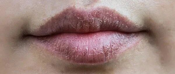 一到秋天，嘴唇就起皮？原来错了那么多年，润唇膏其实该竖着涂