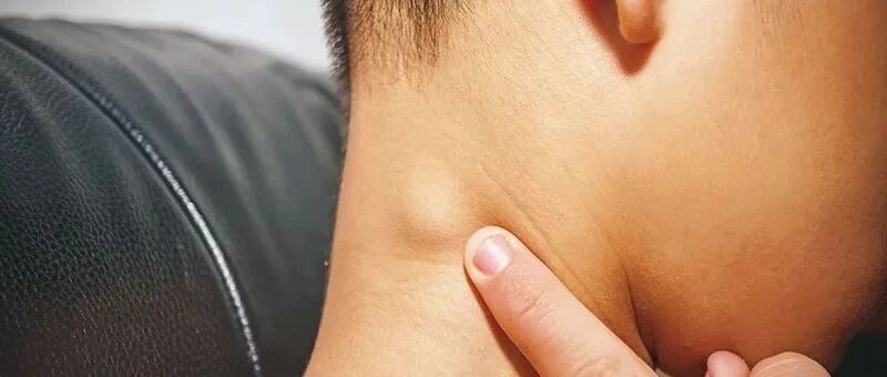 淋巴结肿大，可能疼比不疼好！这些部位摸一摸可自查......