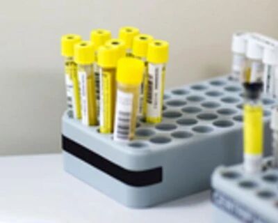 WADA发现18名举重运动员通过他人冒名顶替逃避兴奋剂检测