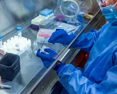 外媒：白宫被指或用疫苗服务大选 专家担心美疾控中心受摆布